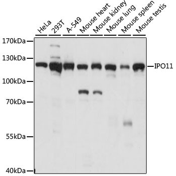 Importin 11 Antibody in Western Blot (WB)