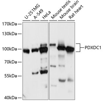 PDXDC1 Antibody in Western Blot (WB)