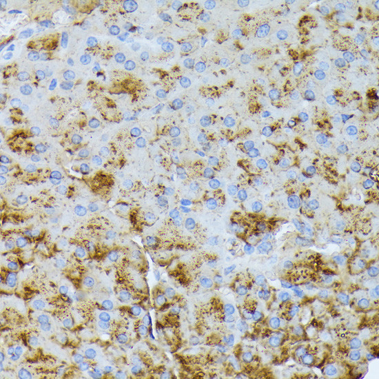 CTRB1 Antibody in Immunohistochemistry (Paraffin) (IHC (P))