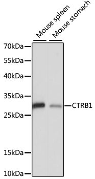 CTRB1 Antibody in Western Blot (WB)