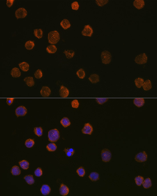 CD11c Antibody in Immunocytochemistry (ICC/IF)