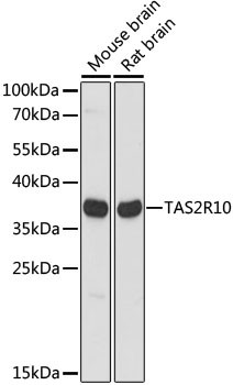 TAS2R10 Polyclonal Antibody