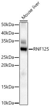 TRAC-1 Antibody in Western Blot (WB)