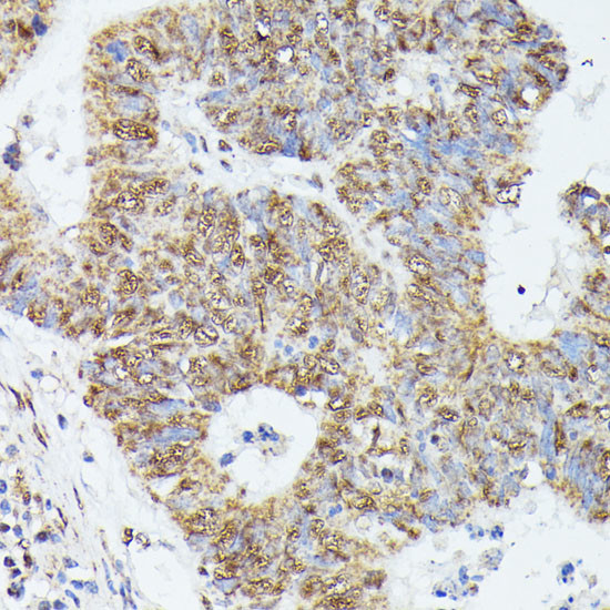 KID Antibody in Immunohistochemistry (Paraffin) (IHC (P))