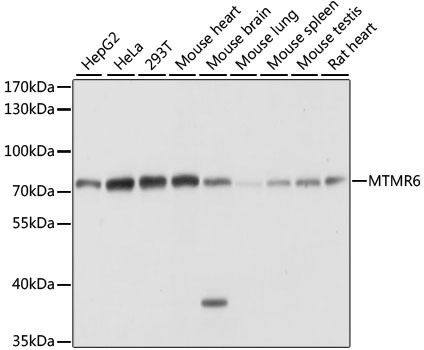 MTMR6 Antibody in Western Blot (WB)