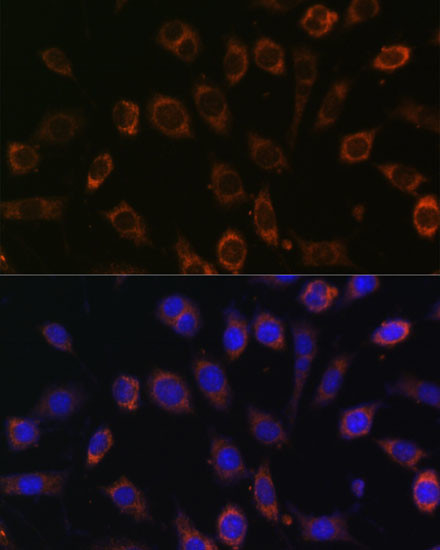 TCIRG1 Antibody in Immunocytochemistry (ICC/IF)