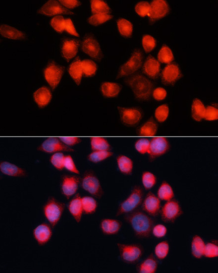 SLC25A5 Antibody in Immunocytochemistry (ICC/IF)