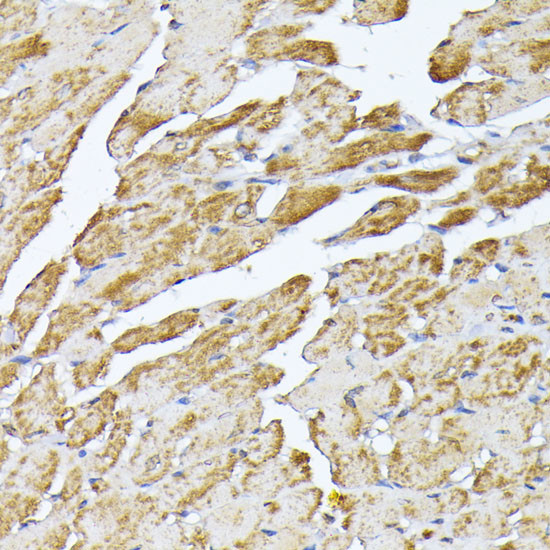 SLC25A5 Antibody in Immunohistochemistry (Paraffin) (IHC (P))