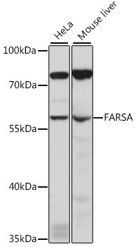 FARSA Antibody in Western Blot (WB)