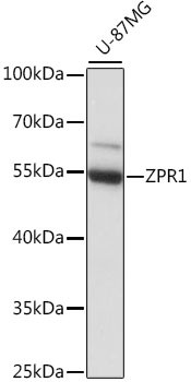 ZPR1 Antibody in Western Blot (WB)