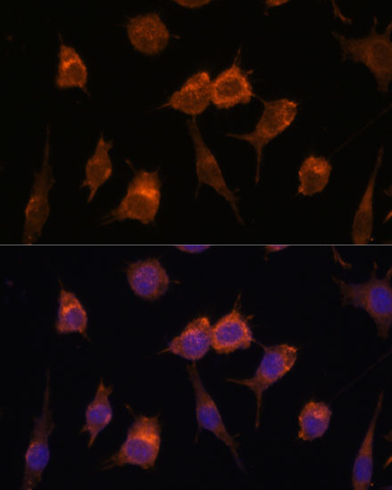 AVIL Antibody in Immunocytochemistry (ICC/IF)