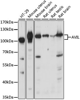 AVIL Antibody in Western Blot (WB)