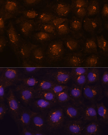 B3GNT4 Antibody in Immunocytochemistry (ICC/IF)