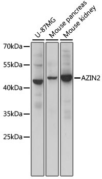 ADC Antibody in Western Blot (WB)