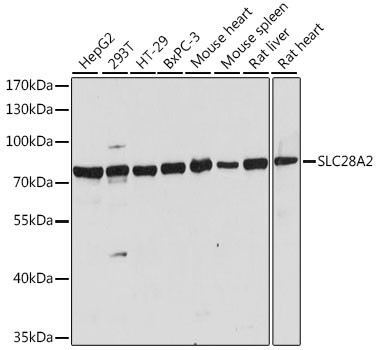 SLC28A2 Antibody in Western Blot (WB)