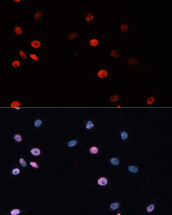 DNMT3B Antibody in Immunocytochemistry (ICC/IF)