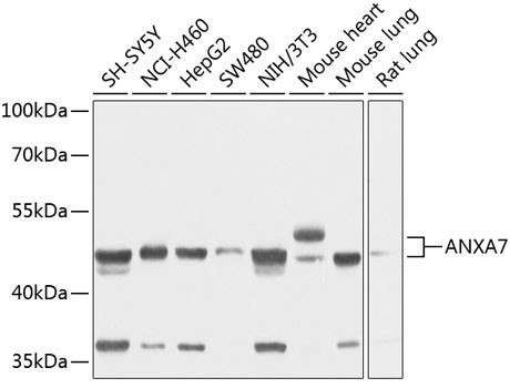 Annexin A7 Antibody in Western Blot (WB)