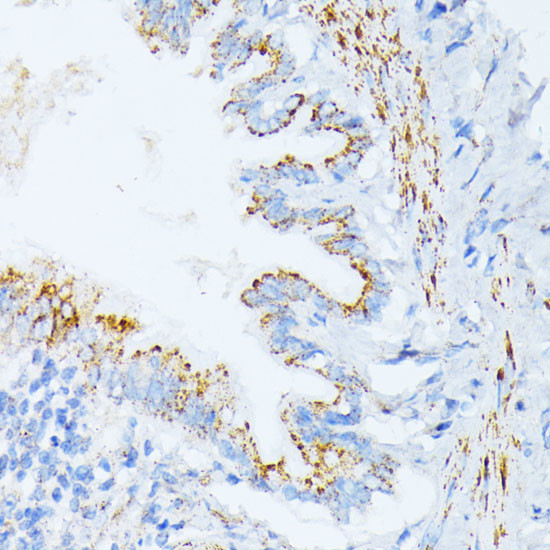 CD123 Antibody in Immunohistochemistry (Paraffin) (IHC (P))