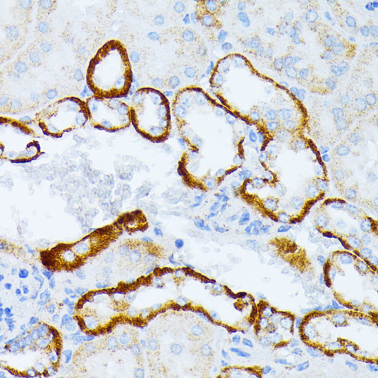 CD123 Antibody in Immunohistochemistry (Paraffin) (IHC (P))