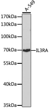 CD123 Antibody in Western Blot (WB)