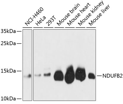 NDUFB2 Antibody in Western Blot (WB)