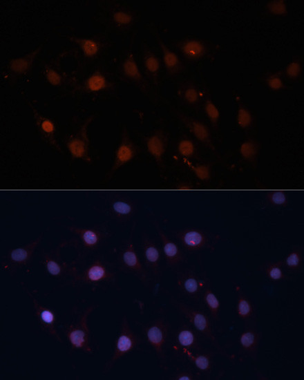 TOM70 Antibody in Immunocytochemistry (ICC/IF)