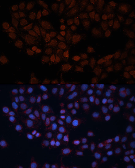 TOM70 Antibody in Immunocytochemistry (ICC/IF)