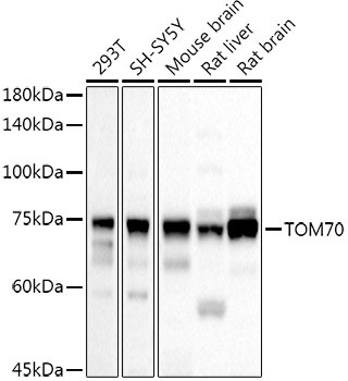 TOM70 Antibody in Western Blot (WB)