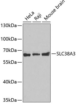 SLC38A3 Antibody in Western Blot (WB)