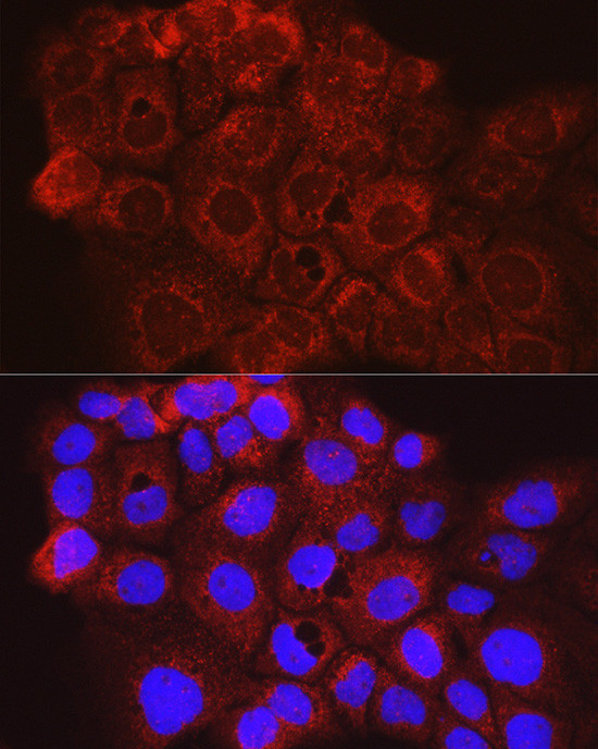 CD63 Antibody in Immunocytochemistry (ICC/IF)