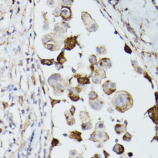 CD63 Antibody in Immunohistochemistry (Paraffin) (IHC (P))