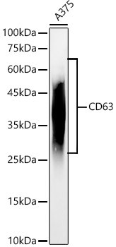 CD63 Antibody in Western Blot (WB)