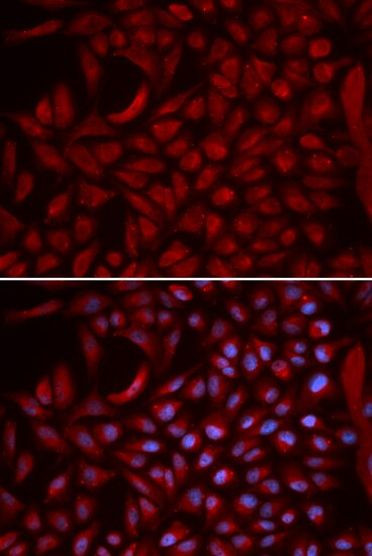 Cullin 5 Polyclonal Antibody (PA5-92425)