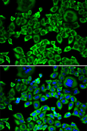 eIF4B Antibody in Immunocytochemistry (ICC/IF)