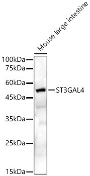 ST3GAL4 Antibody in Western Blot (WB)