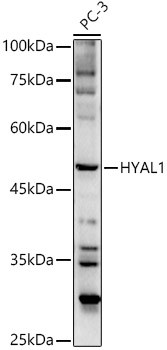 HYAL1 Antibody in Western Blot (WB)