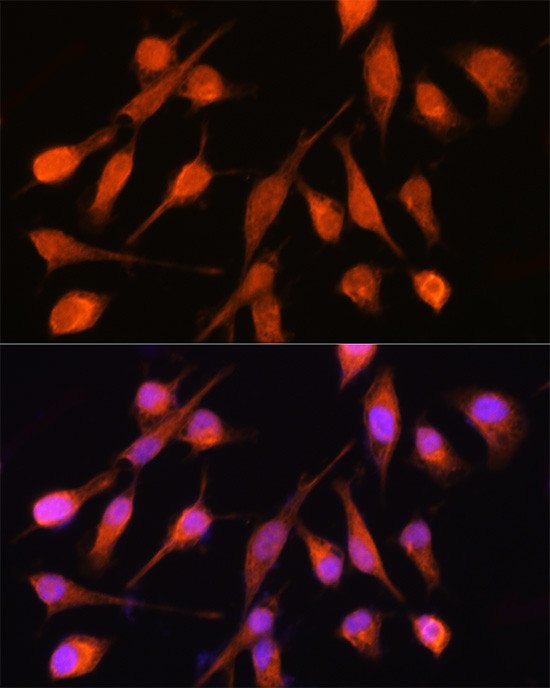 PPM1A Antibody in Immunocytochemistry (ICC/IF)