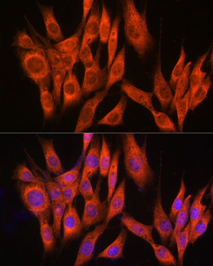 PPM1A Antibody in Immunocytochemistry (ICC/IF)