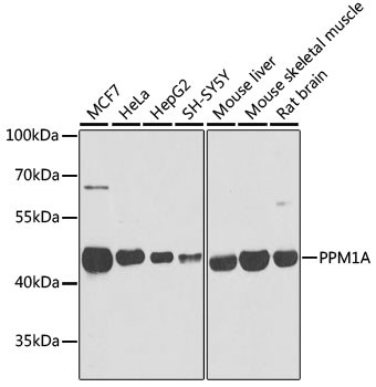 PPM1A Antibody in Western Blot (WB)