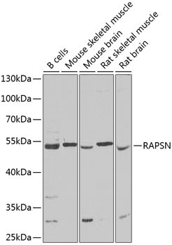RAPSN Antibody in Western Blot (WB)
