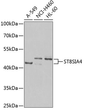 ST8SIA4 Antibody in Western Blot (WB)
