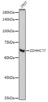 ZDHHC17 Antibody in Western Blot (WB)