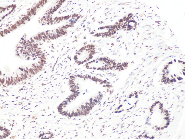 BCL9 Antibody in Immunohistochemistry (Paraffin) (IHC (P))