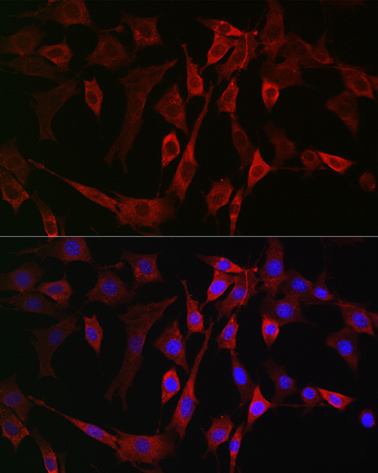 ALOX15B Antibody in Immunocytochemistry (ICC/IF)