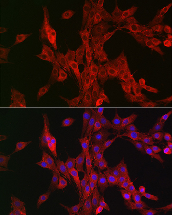 ALOX15B Antibody in Immunocytochemistry (ICC/IF)