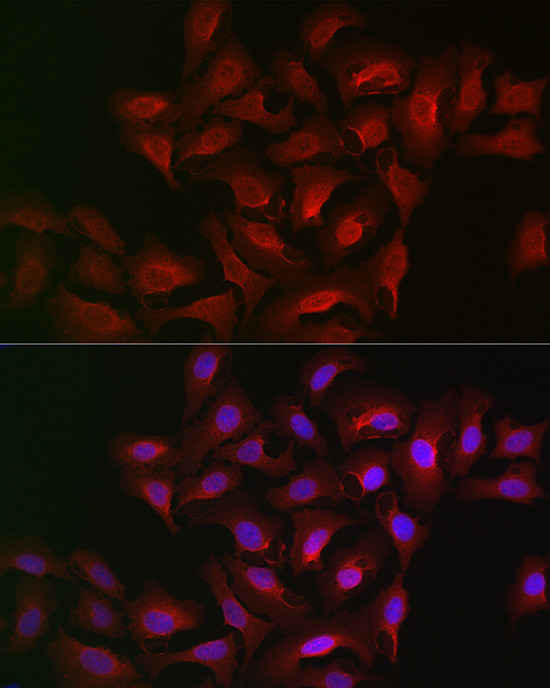 ALOX15B Antibody in Immunocytochemistry (ICC/IF)