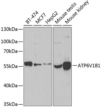 ATP6V1B1 Antibody in Western Blot (WB)