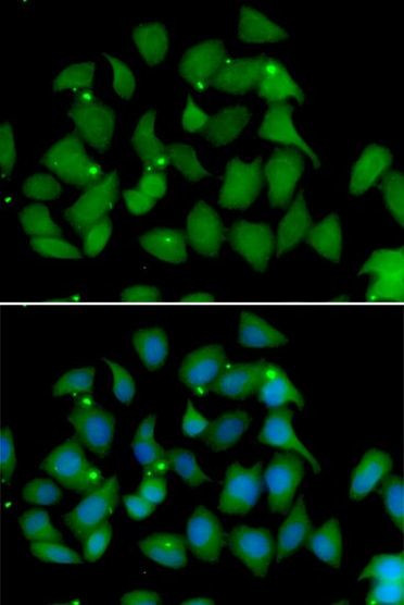 FMO1 Antibody in Immunocytochemistry (ICC/IF)