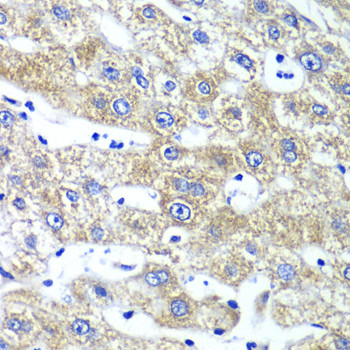 QARS Antibody in Immunohistochemistry (Paraffin) (IHC (P))
