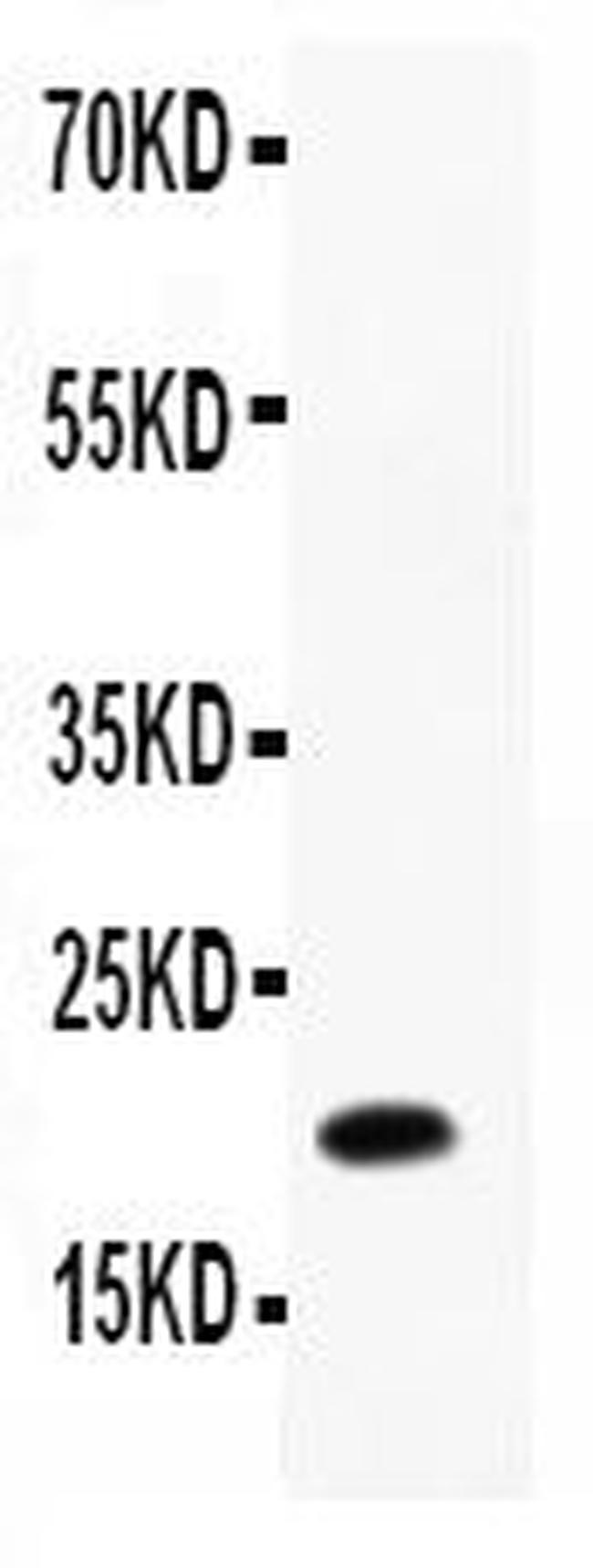 IL-12 p40 Antibody in Western Blot (WB)